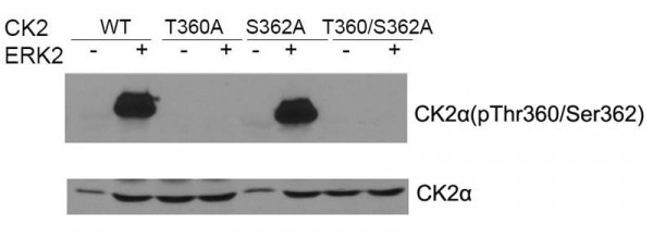 Anti-phospho-CK2 alpha (Thr360/Ser362)