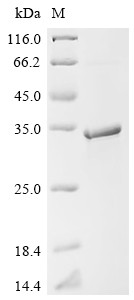 Ras-related protein Rab-6B (RAB6B), human, recombinant