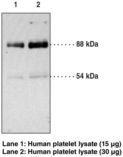 Anti-CD36