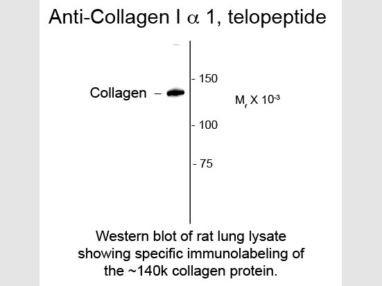 Anti-Collagen 1, alpha 1 telopeptide