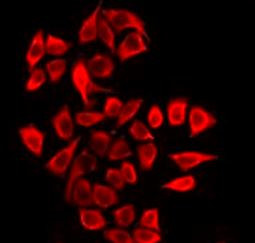 Anti-CLCN5