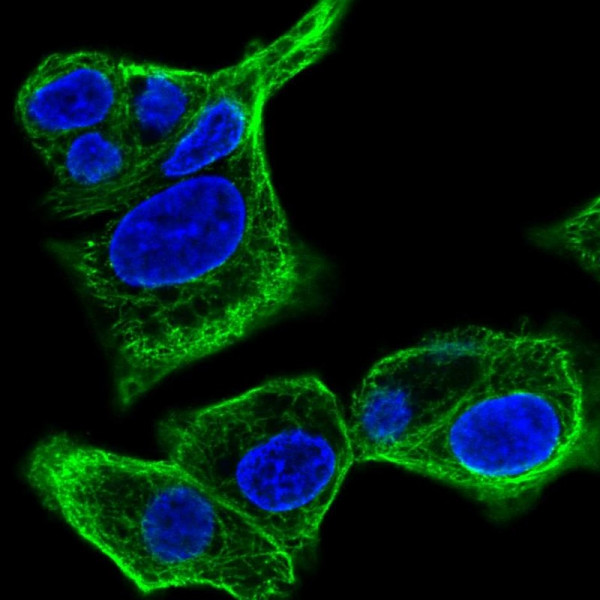 Anti-SPTLC3
