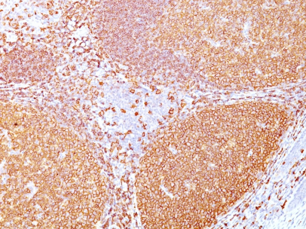 Anti-CD20/ MS4A1 (B-Cell Marker), recombinant antibody, clone rIGEL/773