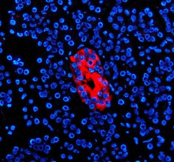 Anti-SLC30A8 / ZNT8 / Zinc transporter 8