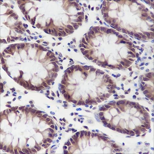 Anti-Recombinant DYNLL1, clone A208
