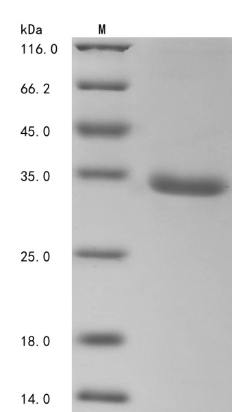 Tripartite motif-containing protein 72 (TRIM72), partial, human, recombinant