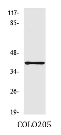 Anti-GPR52