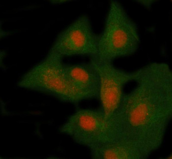 Anti-NSMCE4A / Non-SMC element 4 homolog A
