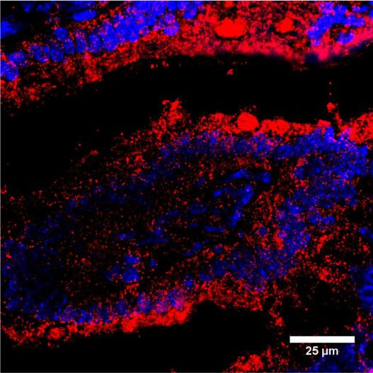 Anti-Guanylyl cyclase C