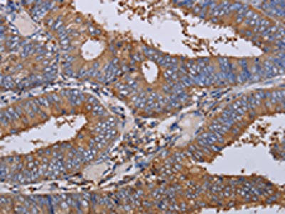 Anti-LIMS1