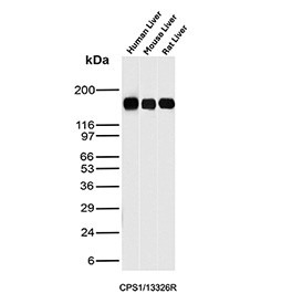 Anti-CPS1 / Carbamoyl-phosphate synthase 1, clone CPS1/13326R