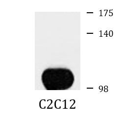 Anti-phospho-beta Catenin (Ser552)