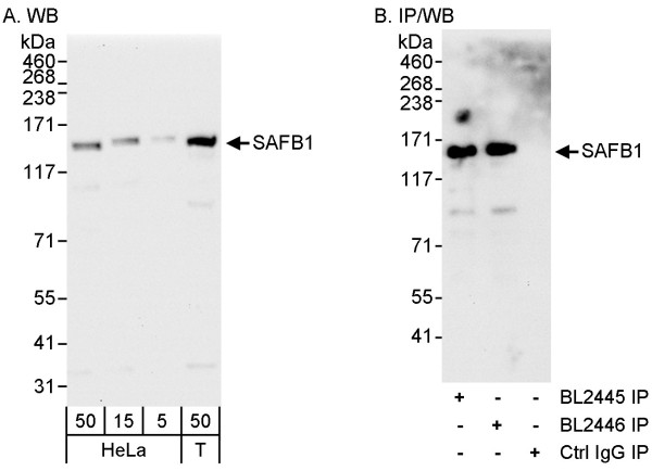 Anti-SAFB1