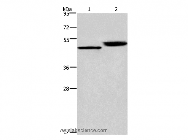 Anti-CTSE