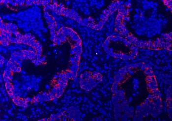 Anti-TRAM1L1 / Translocating chain-associated membrane protein 1-like 1
