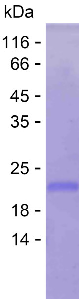 Recombinant Human APMAP Protein