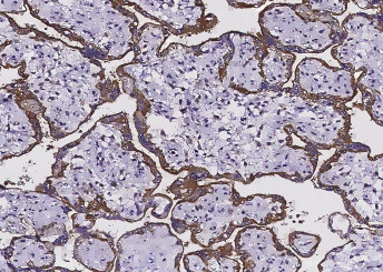 Anti-EGFR/HER1/ErbB1 Monoclonal Antibody