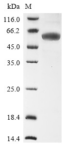 Fructose-bisphosphate aldolase A (ALDOA), human, recombinant