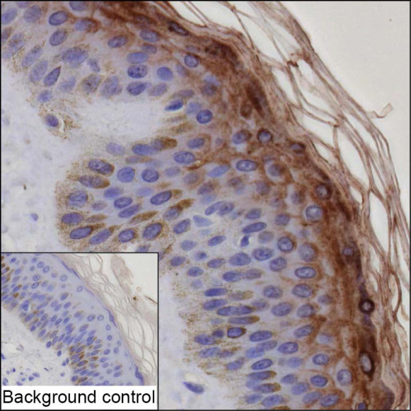 Anti-SBSN
