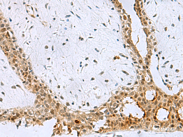 Anti-BCL7B