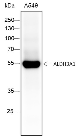 Anti-Recombinant ALDH3A1, clone A125