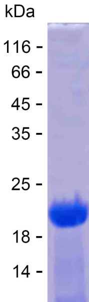 Recombinant Human PDCD2L Protein