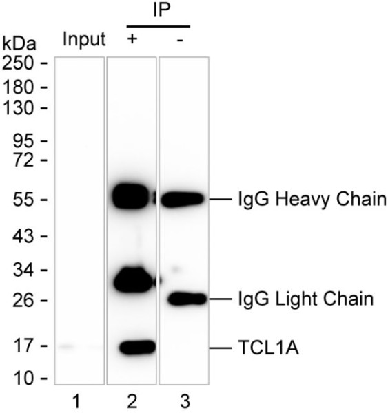 Anti-T Cell Leukemia/Lymphoma Protein 1A