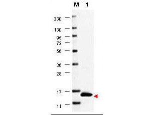 Anti-Granulocyte Macrophage Colony Stimulating Factor (GM-CSF, human)