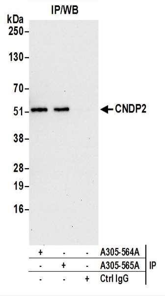 Anti-CNDP2