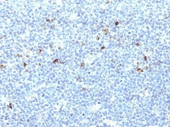 Anti-HLA-A25 + HLA-Aw32, clone CATA-1