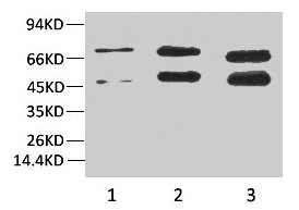 Anti-Phosphoserine Monoclonal