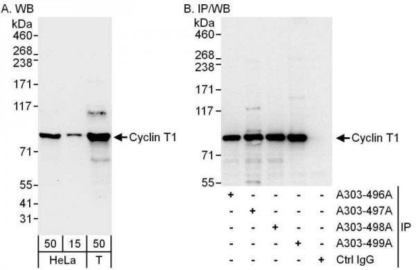 Anti-Cyclin T1