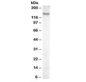 Anti-Pyruvate Carboxylase