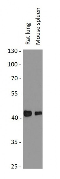 Anti-Haptoglobin