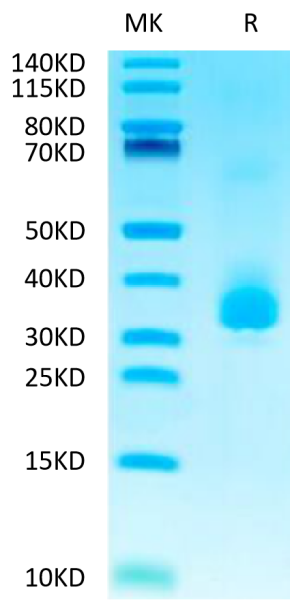 Biotinylated Human ANGPTL3/Angiopoietin-like 3 Protein