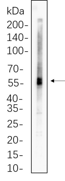 Anti-Recombinant ATGL, clone 4B2