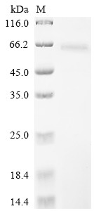 Non-structural polyprotein, partial, Sindbis virus, recombinant