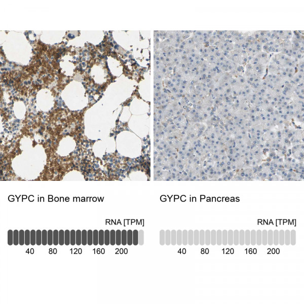 Anti-GYPC
