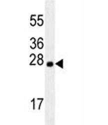 Anti-LXN / Latexin, clone 199CT6.1.2