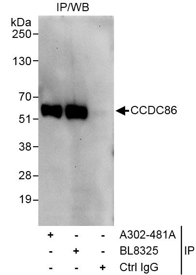 Anti-CCDC86