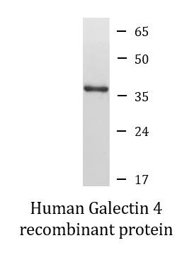 Human Galectin 4 recombinant protein (Active)