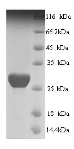 Prestin (SLC26A5), partial, human, recombinant