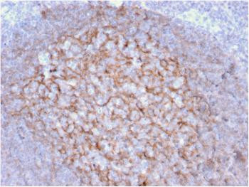 Anti-CD21 (Mature B-Cell &amp; Follicular Dendritic Cell Marker) Monoclonal Antibody (Clone: CR2/1953)