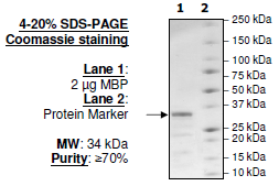 MBP, human recombinant protein, N-terminal His-tag