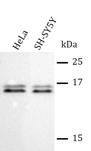 Anti-RBP2 / CRBP2