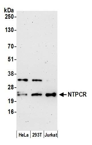 Anti-NTPCR