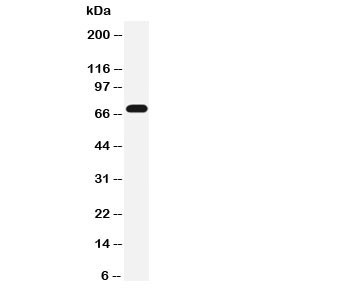 Anti-Serotonin transporter