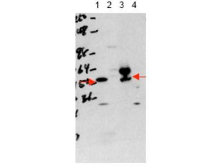 Anti-Thyroid Hormone Receptor alpha (THRA)