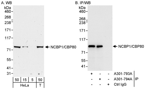 Anti-NCBP1/CBP80