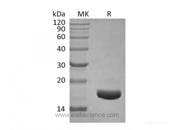 Connective Tissue Growth Factor/CTGF/CCN2 Protein (recombinant human)